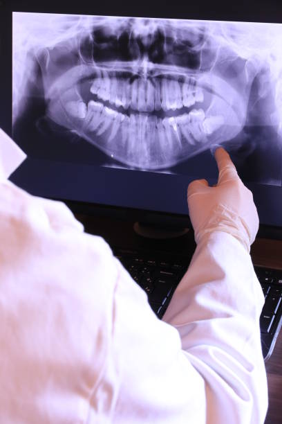 Best Knocked-Out Tooth (Avulsed Tooth) Treatment in Kirkland, IL